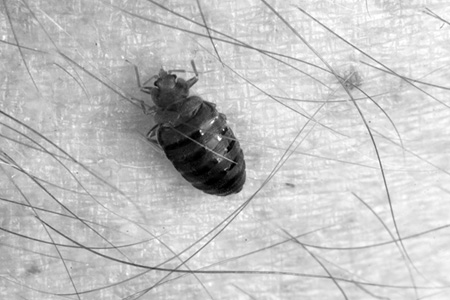 Primer plano del brazo de una persona con un pequeño insecto negro sobre él.